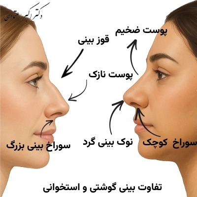 چگونه بفهمیم بینی_مان استخوانی است یا گوشتی؟- بهترین جراح بینی استخوانی در تهران
