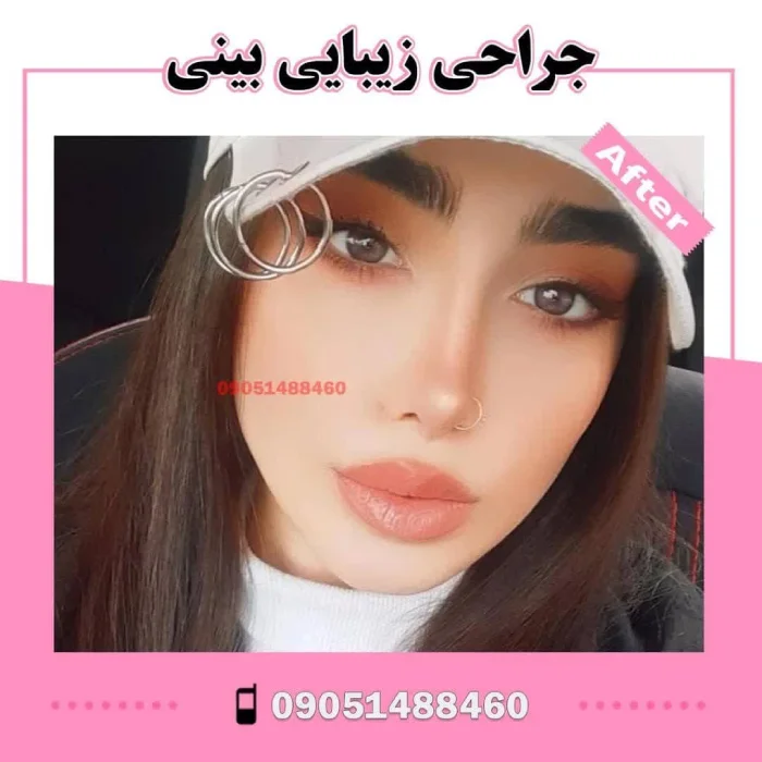 نمونه کار دکتر آرزو خوانساری‌نیا 1