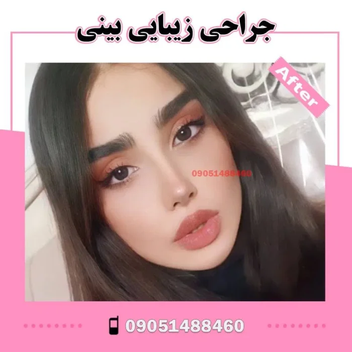 نمونه کار دکتر آرزو خوانساری‌نیا 3