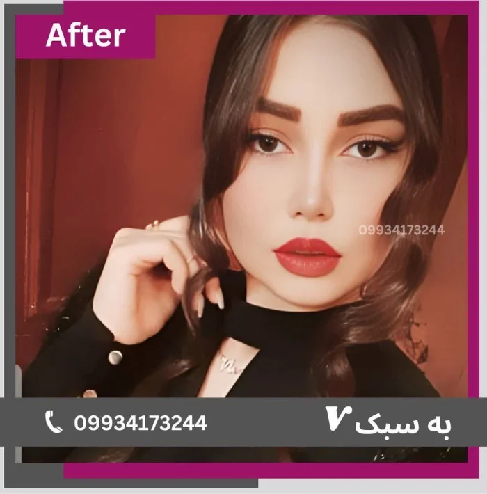 نمونه کار دکتر آرزو خوانساری‌نیا 4