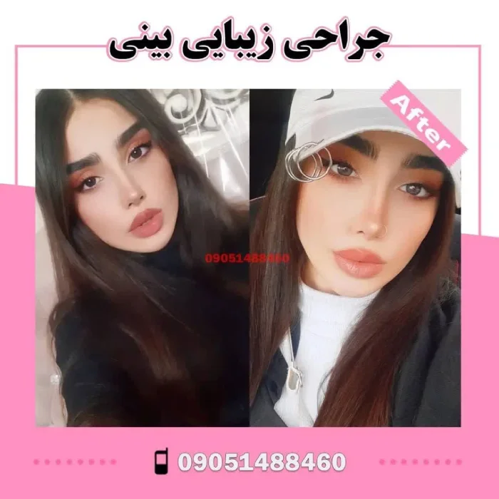 خط پشت بینی صاف و قوس زیبا – فانتزی کنترل‌شده