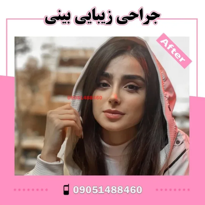 نمونه کار دکتر آرزو خوانساری‌نیا 6