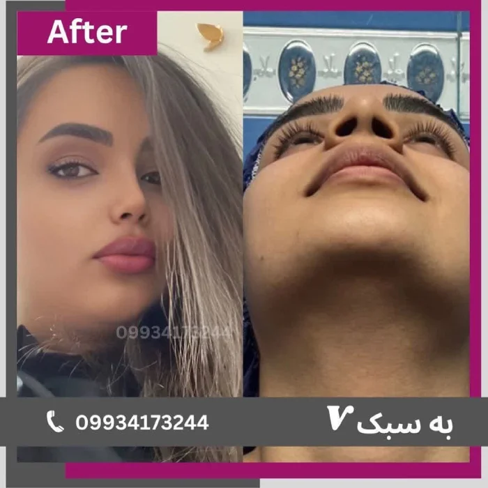 نمونه کار دکتر آرزو خوانساری‌نیا 2
