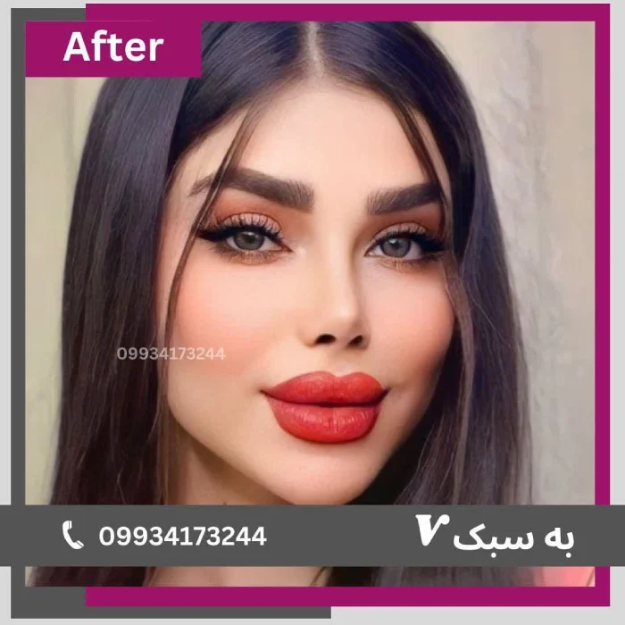 نمونه کار دکتر آرزو خوانساری‌نیا 5