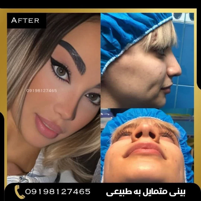 نمونه کار دکتر امین بختیاری 2