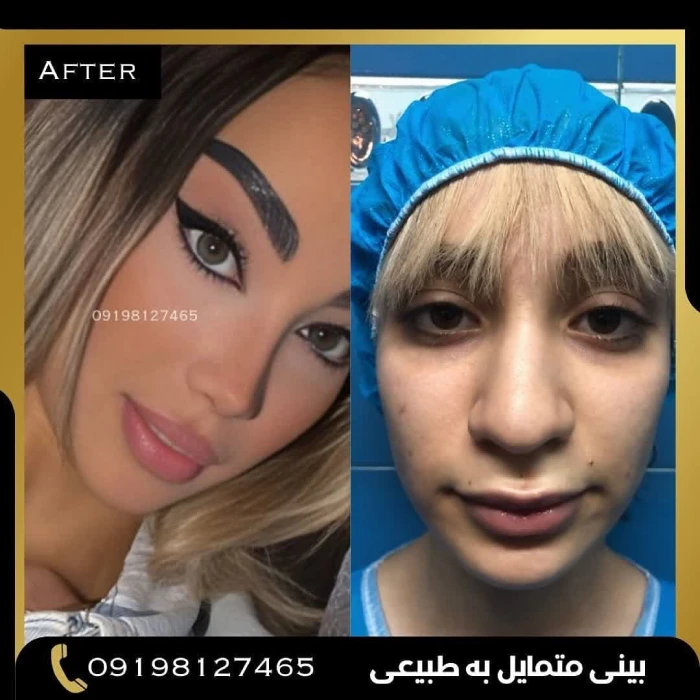نمونه کار دکتر امین بختیاری 3