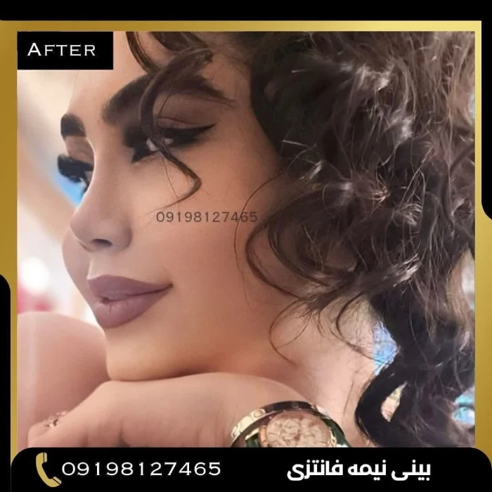نمونه کار دکتر امین بختیاری 4