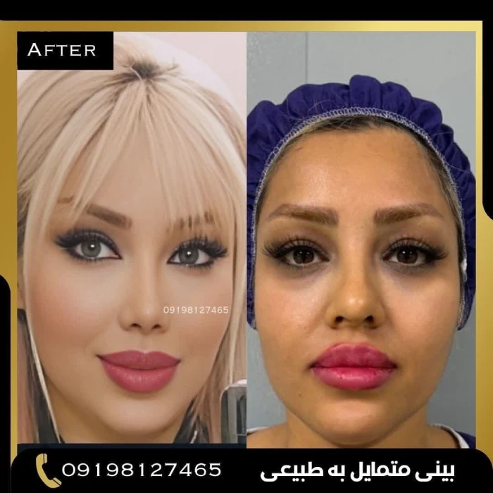 نمونه کار دکتر امین بختیاری 5