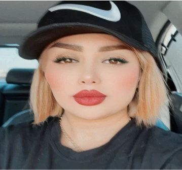 جراحی بینی استخوانی دکتر امین بختیاری - نمونه 3