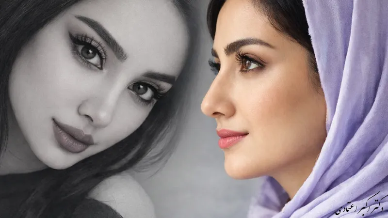 چرا انتخاب مدل بینی باید متناسب با فرم صورت باشد؟