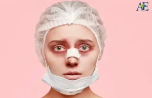 عوارض جراحی بینی (2)