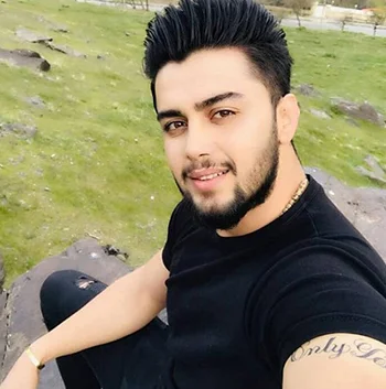 نتیجه جراحی بینی دکتر اکبر اعتمادی