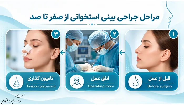 مراحل جراحی بینی استخوانی