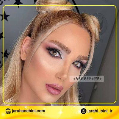 نمونه کار بهترین جراح بینی در تهران